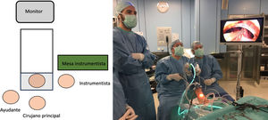 Posicionamiento en quirófano.