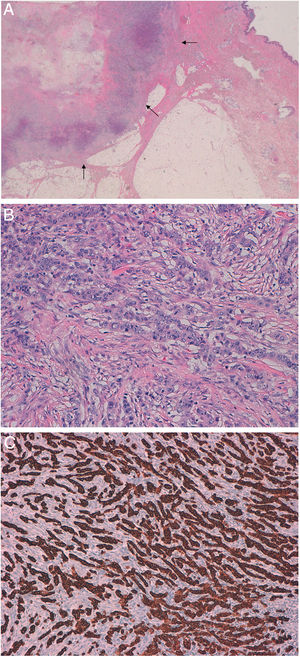 Figura 1