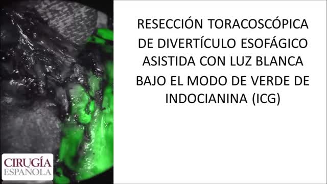 https://ars.els-cdn.com/content/image/1-s2.0-S0009739X21003651-mmc1.mp4