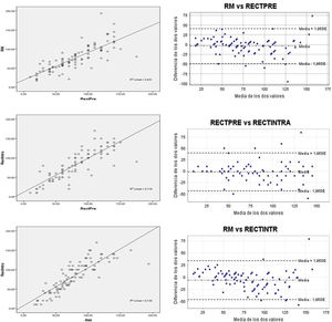 Relación lineal (r) y gráfico de Bland y Altman entre: resonancia magnética (RM) y rectoscopia preoperatoria (RECTPRE); rectoscopia rígida preoperatoria (RECTPRE) e intraoperatoria (RECTINTRA) y RM frente a rectoscopia rígida intraoperatoria (RECTINTRA). Las correlaciones lineales son adecuadas en todas ellas, siendo las mayores en el último grupo comparativo. El gráfico de Bland y Altman muestra gran concordancia y datos generalmente simétricos y agrupados con escasos valores dispersos.