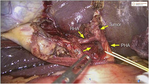 Figura 1