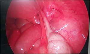 Figura 2