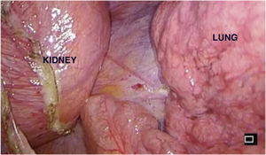 Surgery vision.