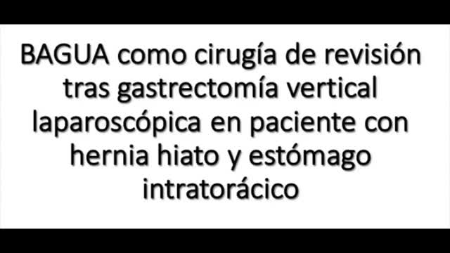 https://ars.els-cdn.com/content/image/1-s2.0-S0009739X22002287-mmc1.mp4