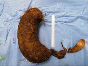 Figura 2