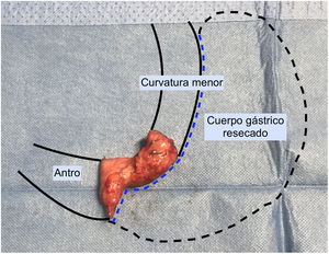 Figura 3