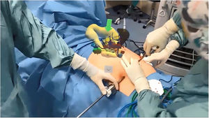 Superimposición anatómica. Superimposición de la anatomía quirúrgica del paciente como guía intraoperatoria.