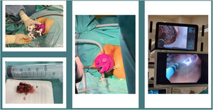 Dispositivo UNI-VEC®.