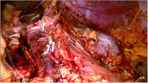Figura 1