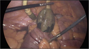 Figura 1