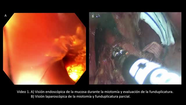 https://ars.els-cdn.com/content/image/1-s2.0-S0009739X23000817-mmc1.mp4
