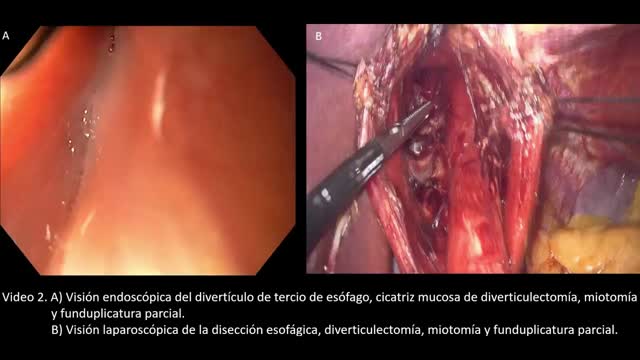 https://ars.els-cdn.com/content/image/1-s2.0-S0009739X23000817-mmc2.mp4
