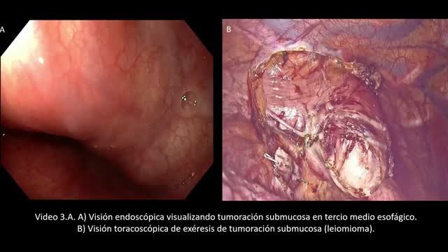 https://ars.els-cdn.com/content/image/1-s2.0-S0009739X23000817-mmc3.mp4