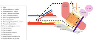 Dibujo esquemático del plano de disección de la escisión casi total del mesorrecto (línea negra discontinua) en el abordaje laparoscópico del near-TME. Se observa un nervio vesical y un tronco nervioso que se divide rápidamente en dos ramas: el nervio vaginal, que inerva el útero y la vagina, y el nervio rectal superior, que inerva la parte superior de la superficie anterior del recto. La rama vaginal posterior se dirige en dirección a la pared vaginal posterior, cuyas ramas cruzan el tabique rectovaginal y se distribuyen a la pared rectal anterior.