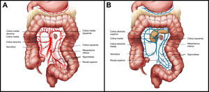 Esquema ilustrativo de la anatomía quirúrgica del colon. A) Arterial y B) Venosa.