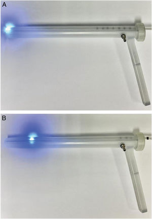 A) Rectoscopio con la fuente de luz móvil en posición inicial ubicado en el borde distal del tumor. B) Rectoscopio en el que la fuente de luz ha sido desplazada a la distancia deseada por el cirujano. La fuente de luz, visible por transiluminación para el cirujano, se desplaza en sentido distal en el rectoscopio la distancia deseada respecto al tumor y se corresponde con el margen de sección distal.