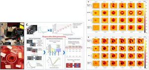 Montaje experimental de sistema láser, una cámara térmica que registra los valores de temperatura durante todo el procedimiento y una cámara hiperespectral. Detalle de una zona objetivo después del tratamiento136. Variación normalizada de imagen hepática para los cuatro rangos espectrales peculiares. Las imágenes se obtienen con respecto a la condición inicial para dos pruebas y para los seis umbrales de temperatura136.