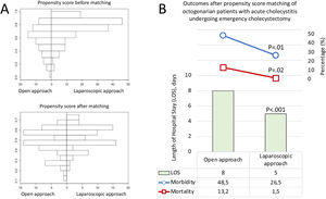 Panel A: Octogenarian patients with acute cholecystitis distributed according to the open approach or laparoscopy, before (baseline population) or after propensity score matching. Panel B: Length of stay (LOS), 30-day morbidity and 30-day mortality of octogenarian patients with acute cholecystitis distributed according to the open or laparoscopic approach after propensity score matching.