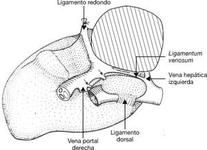 Vista del lóbulo caudado desde el lado izquierdo.