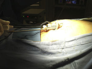 Colocación del puerto de trabajo.