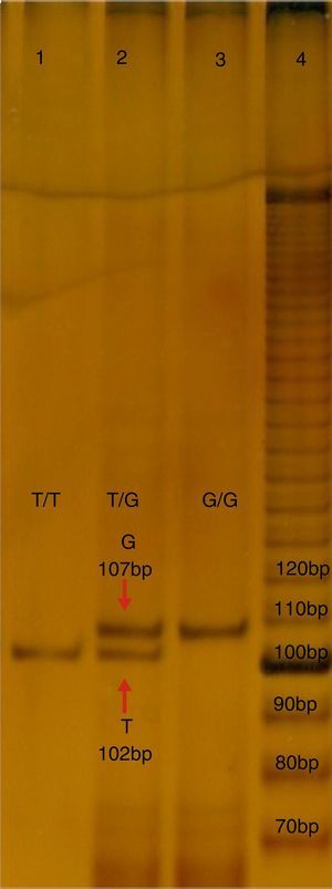 Electroforesis en poliacrilamida al 7%, TBE 0.5X, del PCR-PASA para el SNP rs2291166 de TJP1. En el carril número 4 corresponde al corrimiento del marcador de 10 bases (life-tecnologies). El carril 1 y 3 corresponden a muestras de probandos homocigotos T y G, el carril 2 corresponde a un heterocigoto. Bp:pares de bases.