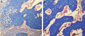 Tinciones histológicas con tricrómico de Masson para el grupo B. A y B) El tejido de reparación contiene fibras de colágena densas y compactas. En el extremo de las trabéculas en regeneración se observan pocos macrófagos y osteoclastos (TM 20X).