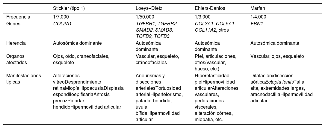 Tablas