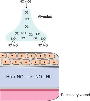 Inhaled NO and its binding to hemoglobin. Hb, hemoglobin; NO, nitricoxide.