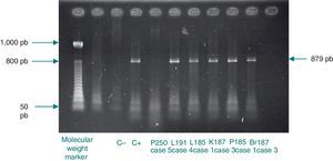 PCR or Polymerase chain reaction CR omp1 gene of Chlamydia trachomatis 879 bp fragment. Deparaffinized samples of organs from autopsy. L=liver, P=lungs, K=kidneys, Br=brain,C−=Negative control, C+=Positive control (Numbers belong to the institutional classification of cases).