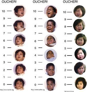 OUCHER scale. Adapted from OUCHER.18 Explain to the child to score that the intensity of the pain increases in the scale from the bottom up and ask her to point to the figure that demonstrates the intensity of pain she is feeling at the moment.