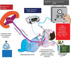 Delivery room management in congenital diaphragmatic hernia (CDH). Oxidative stress plays an important role in the pathogenesis of pulmonary hypertension and injury to hypoplastic lungs in CDH. Delayed cord clamping, limiting barotrauma (with low ventilator pressures), and restricting FiO2 to target preductal SpO2 in the mid-80 s to low 90 s are important strategies to limit oxidative stress in CDH. DCC, delayed cord clamping; PEEP, positive end-expiratory pressure. Copyright Satyan Lakshminrusimha.