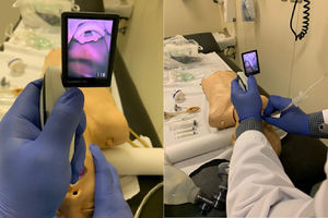 Resident training using simulator and videolaryngoscopy.