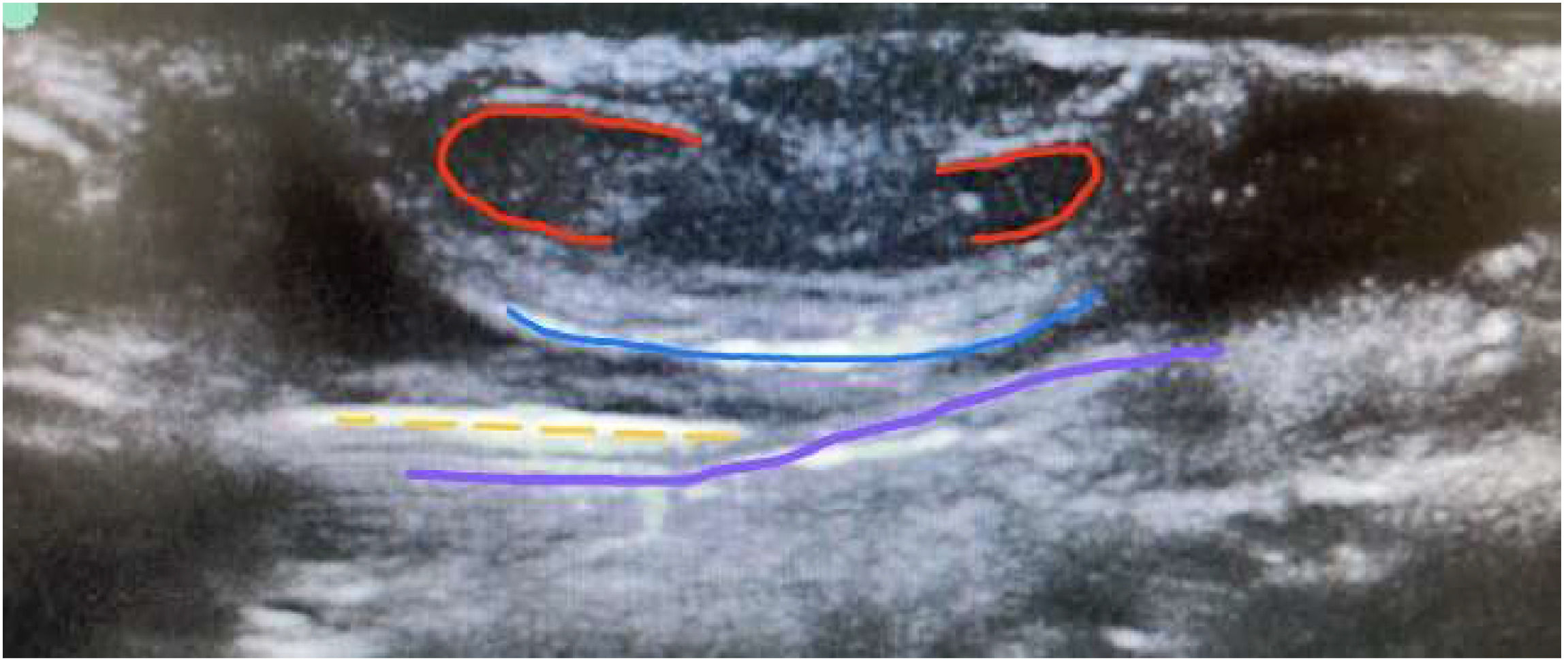 fig0002