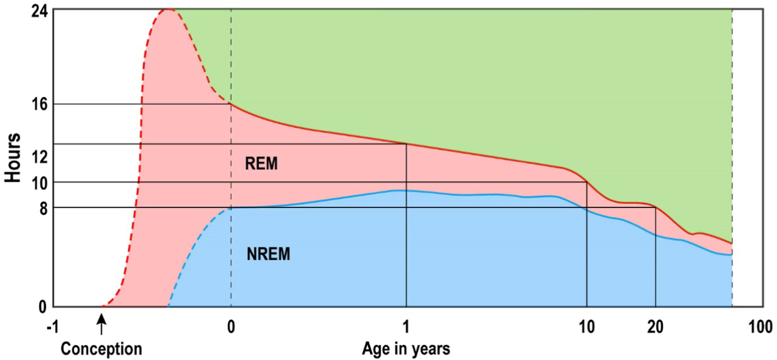 Climate change and its impact on children and adolescents sleep ...