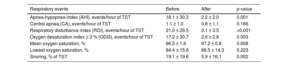 Tables