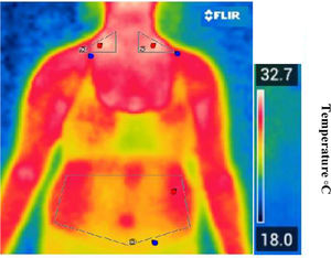 Representative thermal image captured by the thermal camera illustrating temperature distribution across thoracoabdominal regions. The color scale reflects surface temperature, with warmer zones (in red/yellow) indicating increased thermal activity and potential BAT regions.