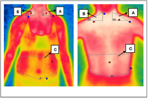 Representation of thermal images taken.