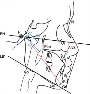 Angular and linear measurements of the cephalometric analysis. Sagittal jaw relationships.