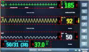 Areas of interest on the multiparameter monitor panel, for evaluating participants