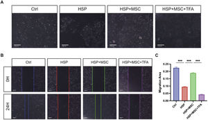 hUC-MSCs restore endothelial morphology and migration by suppressing STAT3. (A) Representative images of HUVECs cultured under the indicated conditions. Scale bar = 100 µm. (B) Wound healing assay images at 0 h and 24 h. Scale bar = 100 µm. (C) Quantification of wound closure. Ctrl: HUVECs cultured with 10% heat-inactivated serum from healthy children. HSP: HUVECs cultured with 10% heat-inactivated serum from HSP patients. HSP + MSC: HSP-conditioned HUVECs co-cultured with hUC-MSCs. HSP+MSC+TFA: HUVECs pretreated with colivelin TFA before HSP-conditioned and co-culture. Data are mean ± SEM, n = 3 independent experiments. *** P < 0.001.