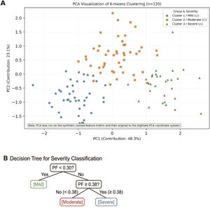 Patient stratification based on multimodal brain function indices. (A) K-means clustering of Z-score–standardized PF, EF, ICP, and rSO2 values identified three patient groups: mild (n = 42), moderate (n = 48), and severe (n = 30). Each dot represents an individual patient, with colors indicating different severity clusters. (B) Decision tree (CART) analysis identified PF as the most critical determinant for stratification, with a threshold of 0.30 separating mild from moderate cases and 0.38 separating moderate from severe cases. ICP and EF contributed secondary discriminative value, while rSO2 was markedly decreased in severe patients, further enhancing classification precision.