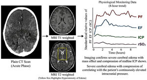 Representative multimodal monitoring profile of a patient with severe cerebral edema and intracranial hypertension. Representative CT and MRI images showing cerebral edema, including acute-phase plain CT, T1-weighted MRI, and T2-weighted MRI with the highlighted edema region (yellow box). Continuous 8-hour physiological monitoring profiles of intracranial pressure (ICP), regional cerebral oxygen saturation (rSO2), edema factor (EF), and perturbation factor (PF) are presented.