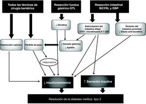 Mecanismos de resolución de la diabetes mediante la cirugía bariátrica. BGYRL: bypass gástrico en «Y» de Roux laparoscópico; DBP: derivación biliopancreática; GTL: gastrectomía tubular laparoscópica.