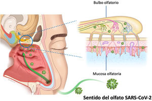 Mecanismo potencial de lesión del neuroepitelio por efecto del SARS-CoV-2 en la vía olfatoria humana.