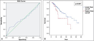(A) Receiver operating characteristic (ROC) curve for % of COVID-19-related lung involvement from the study patients admitted at the Hospital Geral de Fortaleza in 2021. (B) Sixty day–survival curve from the study patients admitted at the Hospital Geral de Fortaleza in 2021, comparing lower and higher cut-off (%) of COVID-19-related lung involvement.
