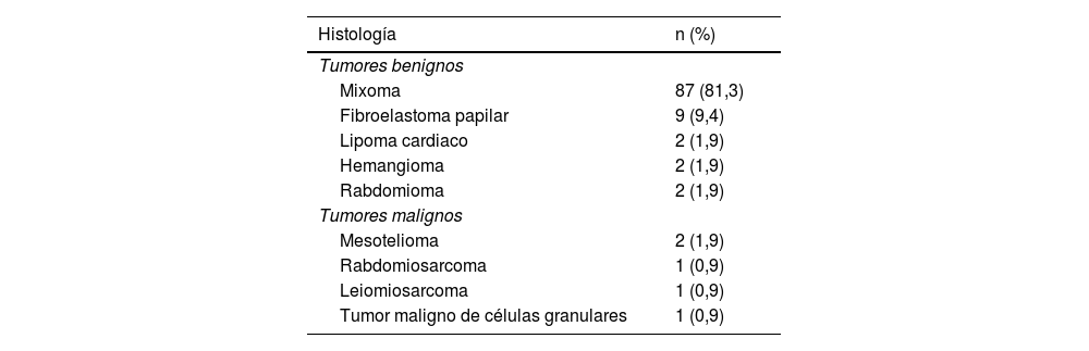 Tablas