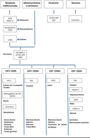 Algoritmo para el diagnóstico del cáncer de origen desconocido mediante inmunohistoquímica. CAM5.2: anticuerpo contra citoqueratinas de bajo peso molecular; CDX2: marcador de cáncer colorrectal; CD10: metaloproteasa expresada en linfomas de células B; CK AE1/AE3: citoqueratina AE1/AE3; CK7: citoqueratina 7; CK20: citoqueratina 20; EMA: epithelial membrane antigen («antígeno de membrana epitelial»); GATA3: factor de transcripción asociado a tumores de mama y uroteliales; HepPar-1: hepatocyte paraffin 1 («hepatocito de parafina 1»); LCA: leukocyte common antigen («antígeno leucocitario común»); NCAM: neural cell adhesion molecule («molécula de adhesión celular neuronal»); PSA: prostate specific antigen («antígeno prostático específico»); p63: factor de transcripción relacionado con p53; RE: receptor de estrógenos; RP: receptor de progesterona; S100: proteína de la familia S100 con función en señalización celular; TTF1: thyroid transcription factor 1 («factor de transcripción tiroideo 1»). Modificado de Losa et al.4.