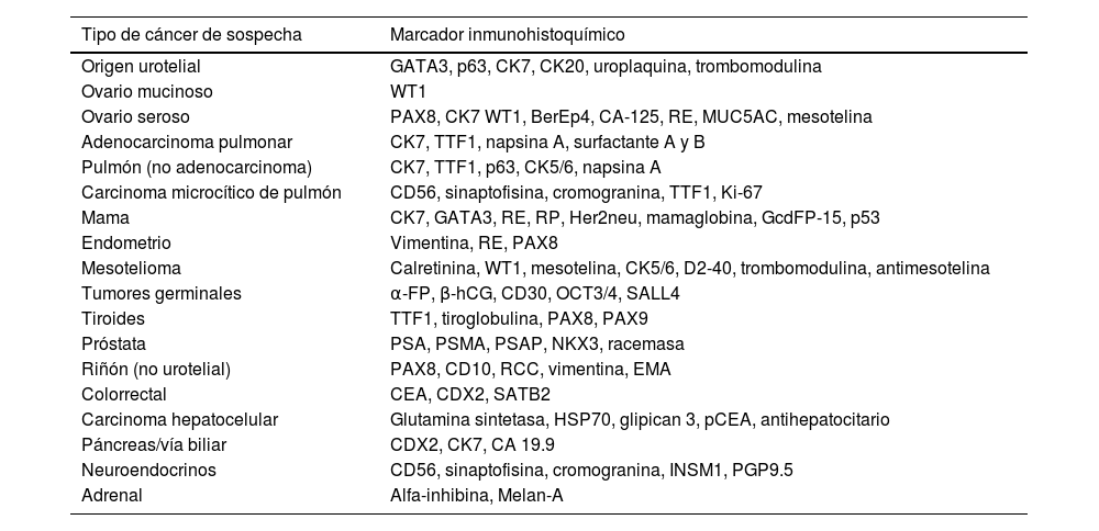 Tablas