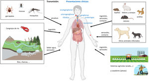 A) Topillo campesino Microtus arvalis y forma clínica orofaríngea confirmada por serología y PCR, con adenopatía de evolución crónica susceptible de punción médica. B) Transmisión de Francisella tularensis por aerosoles, intradérmica e ingestión de alimentos y agua, y formas clínicas de presentación.