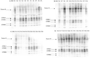 Western blot analysis for detection of CFHR1 deletion. Plasma samples of 25 LN patents (P) and 20 healthy controls were investigated. The samples were deposited on 10% NuPAGE Bis–Tris precast gel (Invitrogen), after transfer, the nitrocellulose membrane was blotted with goat anti-human factor H antiserum (Quidel), diluted 1/1000, followed by a secondary anti-goat-HRP antibody.